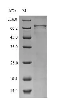 SDS-PAGE - Recombinant Human CNGA4 Protein (His Tag) (AB314630)