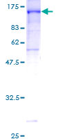 SDS-PAGE - Recombinant Human CNK1 protein (AB160905), expandable thumbnail