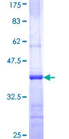 SDS-PAGE - Recombinant Human CNK1 protein (AB160906), expandable thumbnail