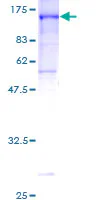 SDS-PAGE - Recombinant Human CNK1 protein (GST tag N-Terminus) (AB160905)