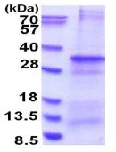 SDS-PAGE - Recombinant Human CNPY4 protein (His tag N-Terminus) (AB181906)
