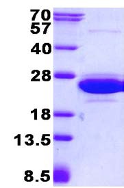 SDS-PAGE - Recombinant Human CNRIP1 protein (AB134552), expandable thumbnail