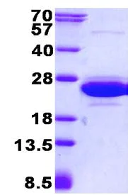 SDS-PAGE - Recombinant Human CNRIP1 protein (His tag N-Terminus) (AB134552)
