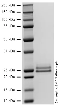 SDS-PAGE - Recombinant human CNTF protein (Active) (AB283456)