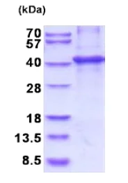 SDS-PAGE - Recombinant Human CNTFR protein (denatured) (His tag N-Terminus) (AB202624)