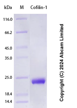 SDS-PAGE - Recombinant Human Cofilin-1 Protein Standard (His tag) (AB323086)