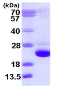SDS-PAGE - Recombinant Human Cofilin 2 protein (His tag N-Terminus) (AB111635)