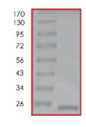 Recombinant Human Cofilin protein