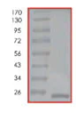SDS-PAGE - Recombinant Human Cofilin protein (AB85154)