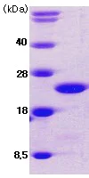 SDS-PAGE - Recombinant Human Cofilin protein (His tag N-Terminus) (AB62958)