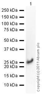 Western blot - Recombinant Human Cofilin protein (His tag N-Terminus) (AB62958)
