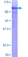 Recombinant Human COL14A1 protein