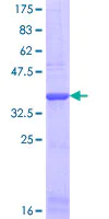 SDS-PAGE - Recombinant Human COL1A2 protein (AB158153)
