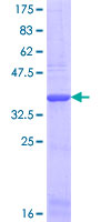 SDS-PAGE - Recombinant Human COL1A2 protein (GST tag N-Terminus) (AB158153)
