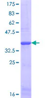 SDS-PAGE - Recombinant Human COL1A2 protein (GST tag N-Terminus) (AB158153)