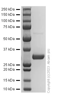 SDS-PAGE - Recombinant Human COL1A2 Protein (His tag) (AB310792)