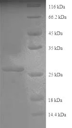 SDS-PAGE - Recombinant Human COL4A2 protein (His tag) (AB238233)