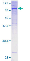 Recombinant Human COL5A1 protein