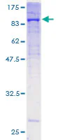 SDS-PAGE - Recombinant Human COL5A1 protein (GST tag N-Terminus) (AB158159)