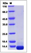 SDS-PAGE - Recombinant Human COL6A3 protein (His tag) (AB276722)