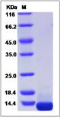 SDS-PAGE - Recombinant Human COL6A3 protein (His tag) (AB276722)