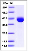 SDS-PAGE - Recombinant Human COL9A1 protein (His tag) (AB276472), expandable thumbnail