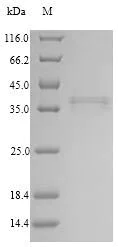SDS-PAGE - Recombinant Human COLEC11 protein (Tagged) (AB267916)