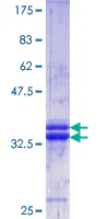 SDS-PAGE - Recombinant Human Collagen I protein (GST tag N-Terminus) (AB158152)
