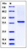 SDS-PAGE - Recombinant Human Collagen II protein (His tag) (AB276433)