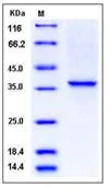 SDS-PAGE - Recombinant Human Collagen II protein (His tag) (AB276433)