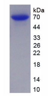 SDS-PAGE - Recombinant Human Collagen III protein (Tagged) (AB275791), expandable thumbnail