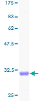 SDS-PAGE - Recombinant Human Collagen IV alpha 6 protein (GST tag N-Terminus) (AB158158)