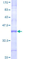 SDS-PAGE - Recombinant Human Collagen XI alpha 2/COL11A2 protein (GST tag N-Terminus) (AB158168)
