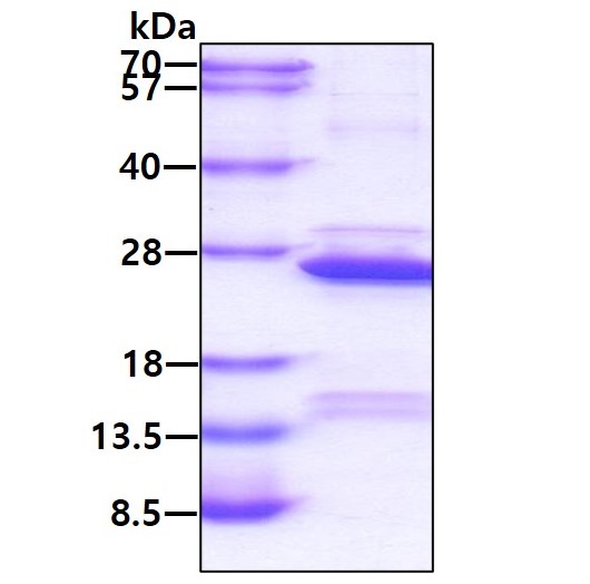 SDS-PAGE - Recombinant Human COMMD1/MURR1 protein (His tag N-Terminus) (AB98077)