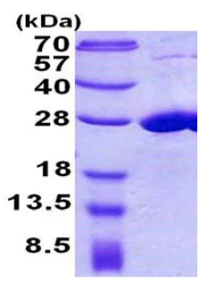 SDS-PAGE - Recombinant Human COMMD7 protein (His tag N-Terminus) (AB156975)