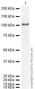 Western blot - Recombinant Human COMP/Cartilage oligomeric matrix protein (AB104358), expandable thumbnail