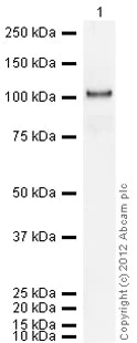 Western blot - Recombinant Human COMP/Cartilage oligomeric matrix protein (AB104358)