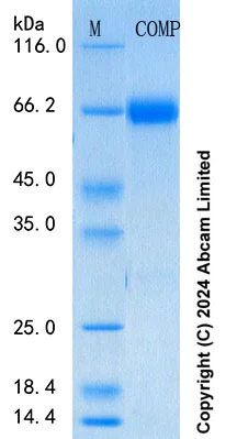 SDS-PAGE - Recombinant Human COMP Protein Standard (His tag) (AB316616)