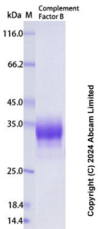 SDS-PAGE - Recombinant Human Complement Factor B (Ba fragment) Protein Standard (AB322695), expandable thumbnail