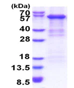 SDS-PAGE - Recombinant Human Complement factor B protein (denatured) (His tag N-Terminus) (AB174401)