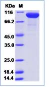 SDS-PAGE - Recombinant Human Complement factor B protein (His tag) (AB276729)