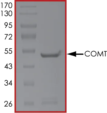 SDS-PAGE - Recombinant human COMT protein (Active) (AB268426)