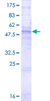 SDS-PAGE - Recombinant Human Connexin 32 / GJB1 protein (AB158522)