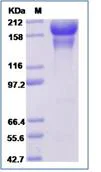 SDS-PAGE - Recombinant Human Contactin 6 protein (AB276736)