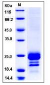 SDS-PAGE - Recombinant Human COQ7 protein (His tag) (AB276471)