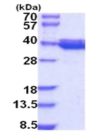 SDS-PAGE - Recombinant Human COQ9 protein (AB202604)