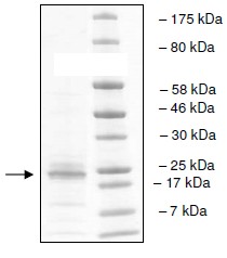 SDS-PAGE - Recombinant Human CoREST protein (His tag N-Terminus) (AB196077)