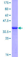 Recombinant Human Corneodesmosin/S protein