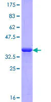 SDS-PAGE - Recombinant Human Corneodesmosin/S protein (GST tag N-Terminus) (AB114567)