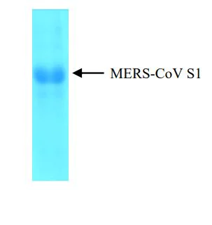 SDS-PAGE - Recombinant Human coronavirus MERS Spike glycoprotein (S1) (His tag) (AB270821)